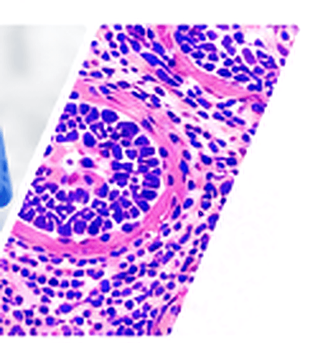 H&E stained tissue slide detail